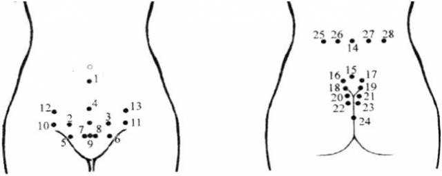 Фото: Как проходит процедура