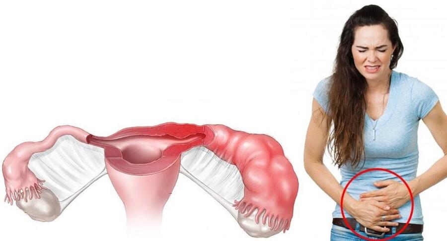 Фото: Симптомы трубного бесплодия