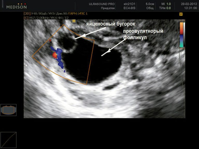 Фото: Методы определения овуляции